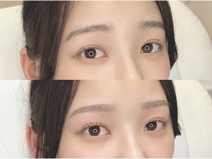 ホワイトアイ 宜野湾(WHITE EYE)の写真