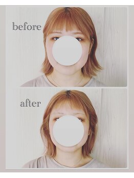 クラーレ(CURARE)/[before、after]