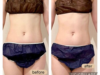 リトモ 銀座(ritmo)/癒しと結果を両立。アロマリンパ