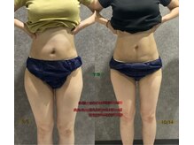 リボーン(REBORN)/産後ケアーダイエット