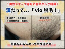 毛抜き屋 可児店/◇Vゾーンの施術経過◇