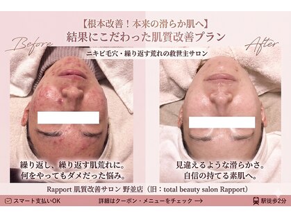 ラポール 野並店(Rapport)の写真