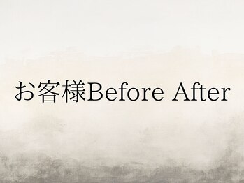 オベリオ(OBERIO)/お客様Before After