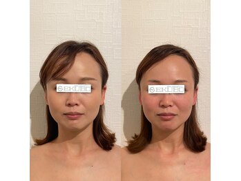 エクボ 立川店(EKUBO)/