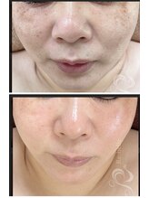 アンパス(Unpas)/もう一歩先のキレイを目指したい