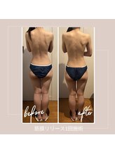 バンブー B2 新涯店(Bamboo)/筋膜リリース