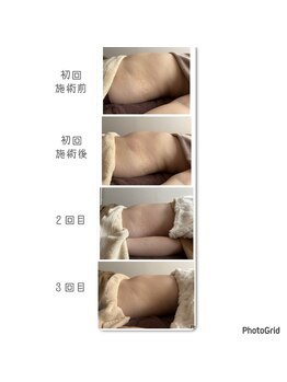 ウェルビー(Well & Be.)/【Hot腸もみ】