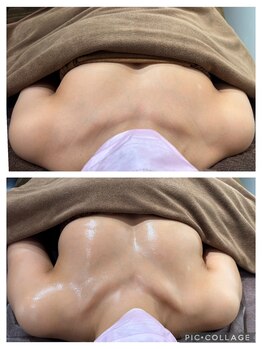 トータルビューティーサロン バンブー(Bamboo)/2ヶ月で2カップup！