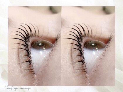 セレクト アイコンシェルジュ 新宿店(SELECT eye concierge)の写真