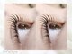 セレクト アイコンシェルジュ 新宿店(SELECT eye concierge)の写真