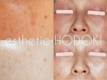 エステティックホドキ(esthetic HODOKI)の雰囲気（神辺で本気のシミケアするならホドキ｜神辺駅前エステ）