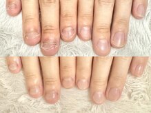 グレースレディ/(深爪/長さだし/フィルイン)