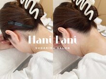 その日にツルツルのお肌で帰れる！角質も取れるシュガーリング☆