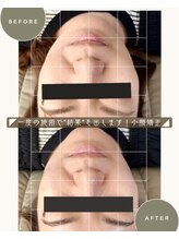 メイジーネイル(Maisie Nail)/小顔矯正