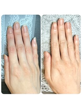 桃の木 吉祥寺店/30代　ハンドケア＆ネイルケア