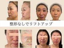 クリアボーテ プリュス(Clear Beaute Plus)