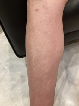 エピシアドットエヌ(epicia.N)/夏は短パンを履く!