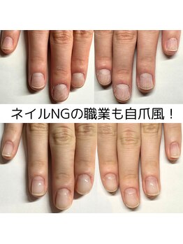 クウ(KUU)/看護師さんに人気!爪育成