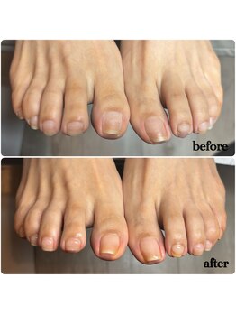 フット自爪育成*美爪*補強