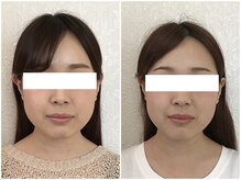 美容整体ウェリナ 名駅院/小顔矯正/骨盤矯正/美脚サロン