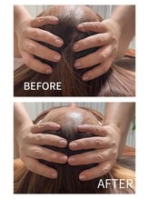 ミンア(Min-a)/水素ショットで頭のサイズが！