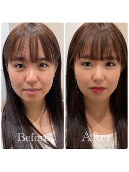 シャルム(Sharme)/お客様Before→After