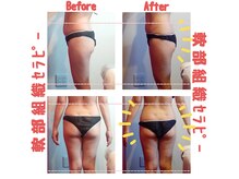 ビューティサロン キヨの部屋(beauty salon)の雰囲気（プロ直伝の技術で筋肉・筋膜・腱にアプローチ！疲れた身体に◎）