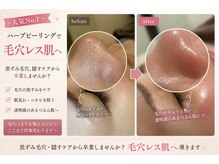 アールズ 南風原(R’s)の雰囲気（繰り返す肌荒れに、根本から整える肌質改善ケアニキビ／毛穴）