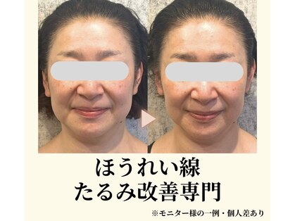 ドゥシール(Docile)の写真