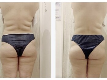 ヨサパーク クレオメ(YOSAPARK Cleome)/身体の悩みに真摯に向き合う！