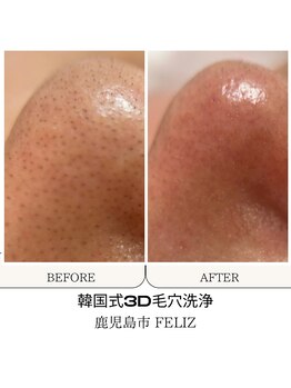 フェリス(FELIZ)/韓国式3D毛穴洗浄