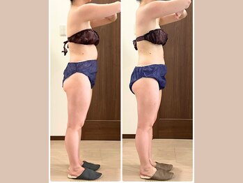 リライブ 亀有店(Re:Lives)/全身ビフォーアフター【痩身】