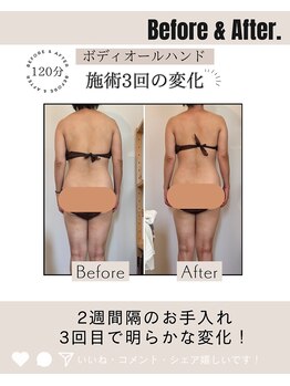 リトリート(Retreat)/2週おきのお手入れ