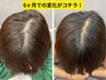 【毛髪カウンセリング/抜け毛・分け目のお悩みに！育毛促進プログラム】