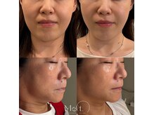 引き締め、お任せください♪