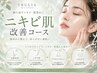 【初回￥10,000】肌質改善！ニキビ・跡改善特化パッケージ