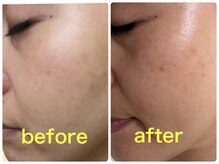 ベルドア(Bell Door)/潤いとツヤ