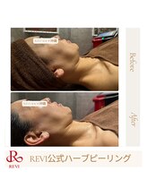 ルヴィショップ 沖縄(REVI SHOP)/コラーゲン生成で美白・美肌に！