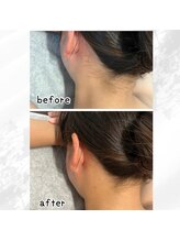 ケースタイル(k.style)/うなじbefore after