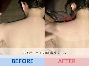 エル 麻布十番(LllL)/首肩こり解消【インディバ】