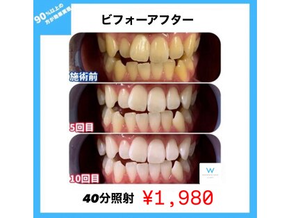 ホワイトニングショップ 京都駅前店の写真