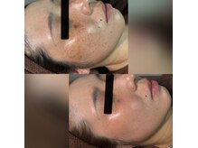 パシテア(Pasithea)