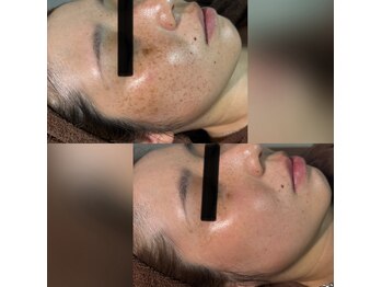 パシテア(Pasithea)