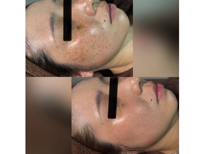 パシテア(Pasithea)の写真