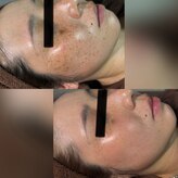 パシテア(Pasithea)