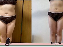 ヨサパーク ミッカ 学芸大学(YOSA PARK MiCCA.)/驚愕の結果パート5