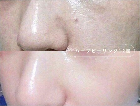 モアスキン 南青山店(MORE SKIN)｜ホットペッパービューティー