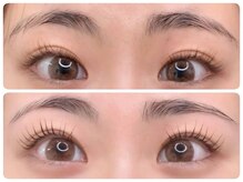 トータルビューティ ノイド(Noid)/パリジェンヌ＆眉WAX脱毛