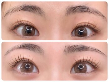 トータルビューティ ノイド(Noid)/パリジェンヌ＆眉WAX脱毛