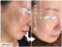 パールホワイトニングサロン 茅ヶ崎店の雰囲気（ハーブピーリング（ダウンタイムあり/なし）で透明感ある素肌へ）
